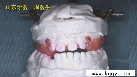 凯斯懊恼错失领先好局 坦言今天的发球不在状态‘hth官网入口’(图3) 华体会体育hth官方网站